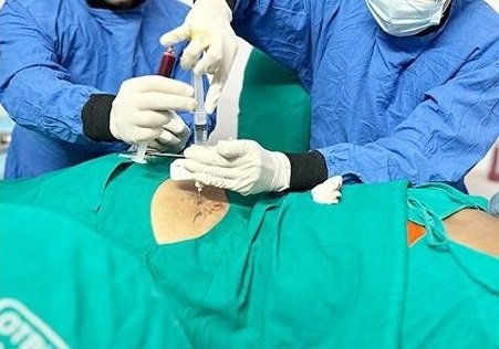 Understanding Stem Cell Therapy in Multan treatment at Le Pearl Aesthetic Clinic