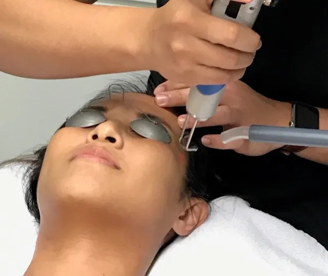 Pigmentation Treatment in Multan for Different Dark Marks treatment at Le Pearl Aesthetic Clinic