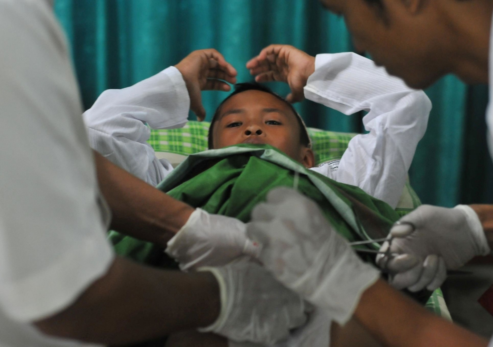 Circumcision in Multan for Newborns, Children and Adults treatment at Le Pearl Aesthetic Clinic