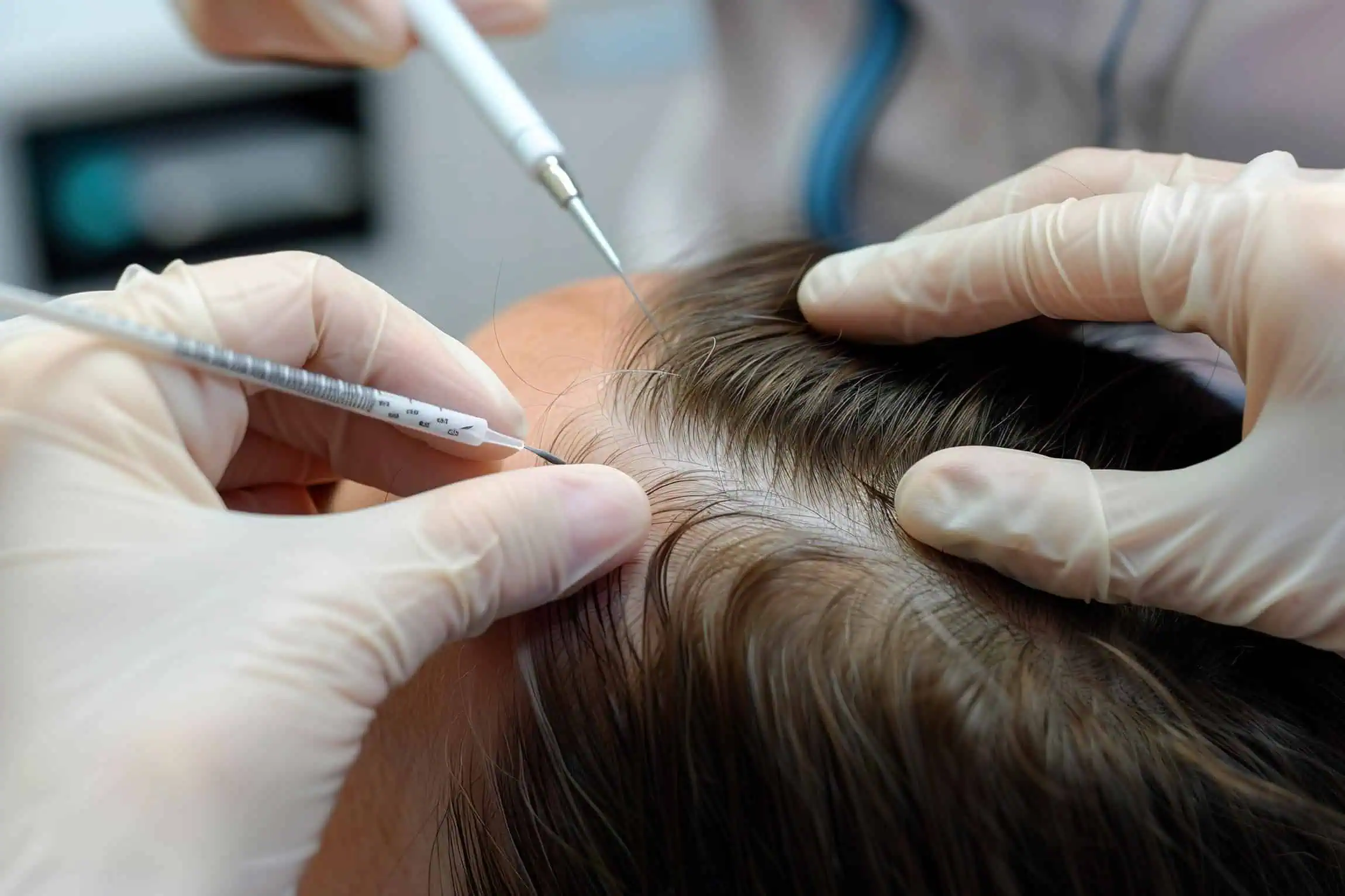 Hair Restoration & Regrowth