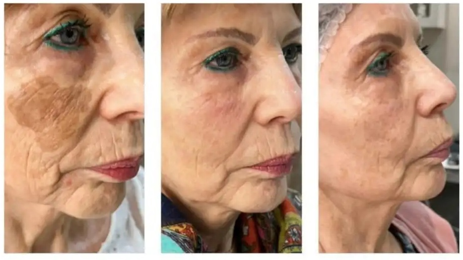 Advanced Aesthetic Procedures